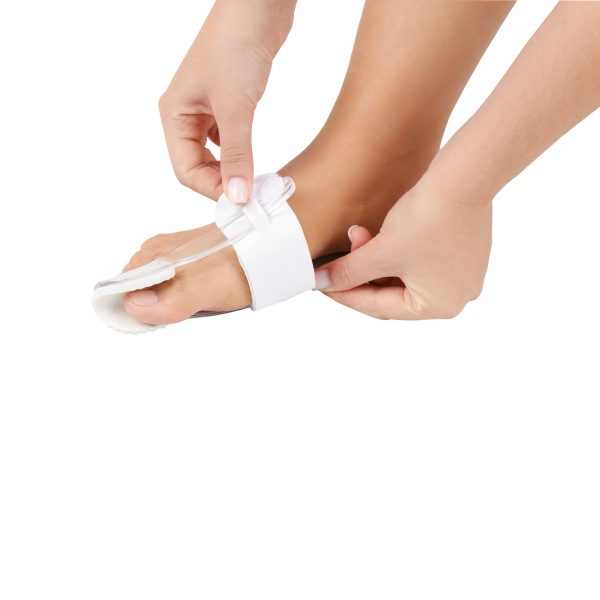 GMed Hallux Valgus kezelő